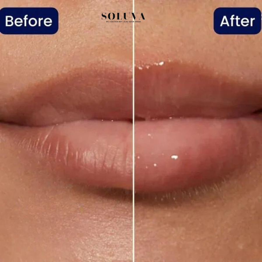 Vitamine E - Verdikkende Lippen Serum - 1+1 Gratis!