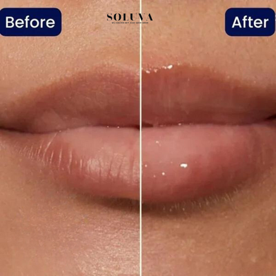 Vitamine E - Verdikkende Lippen Serum - 1+1 Gratis!