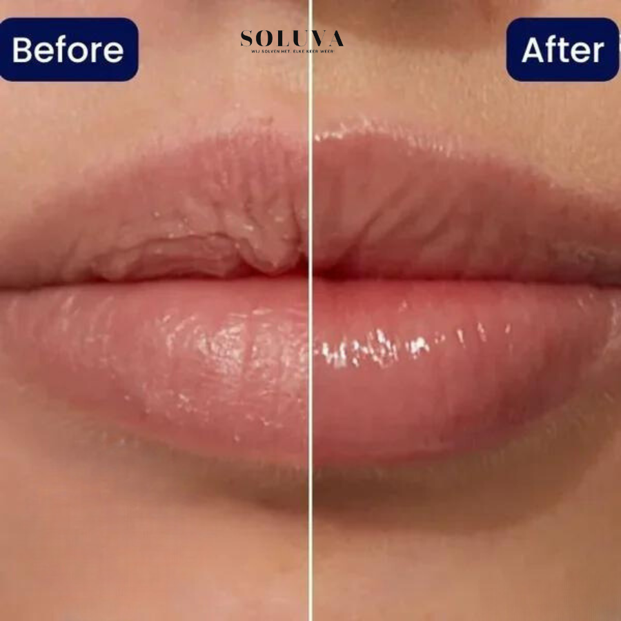 Vitamine E - Verdikkende Lippen Serum - 1+1 Gratis!