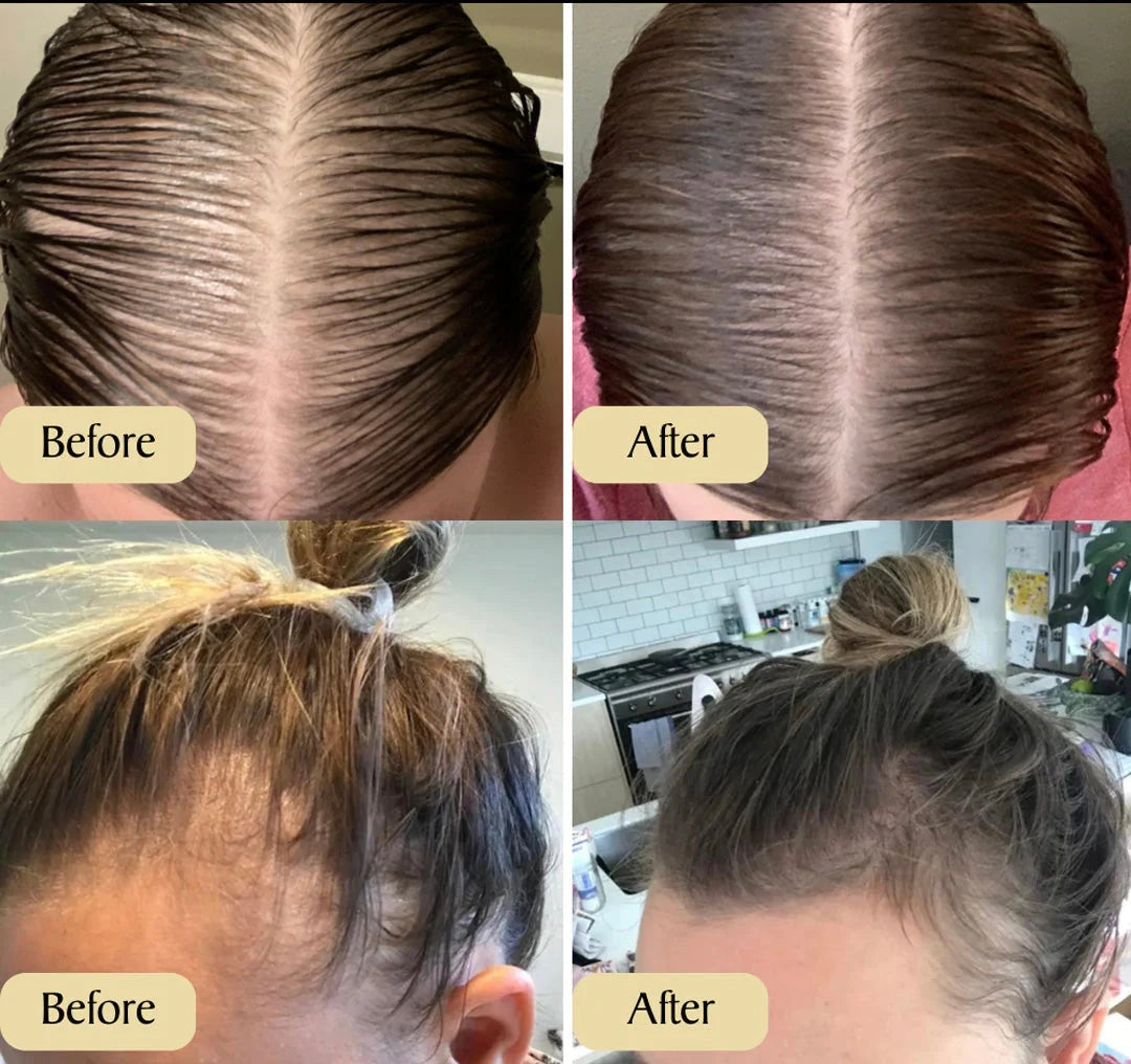 Vegan Haargroei Serum - Alleen Vandaag 1+1 gratis!