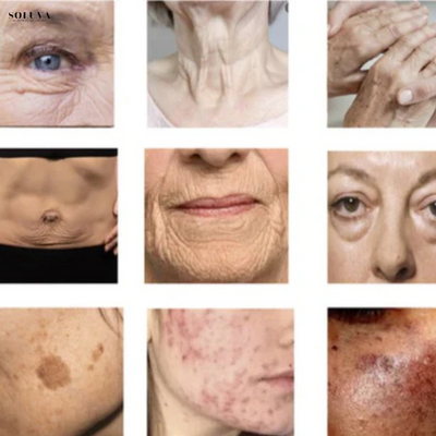 Alra Renewal Serum - hydraterende Anti-Aging Serum