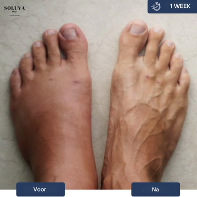 Classy Loafers - Orthopedische Schoenen