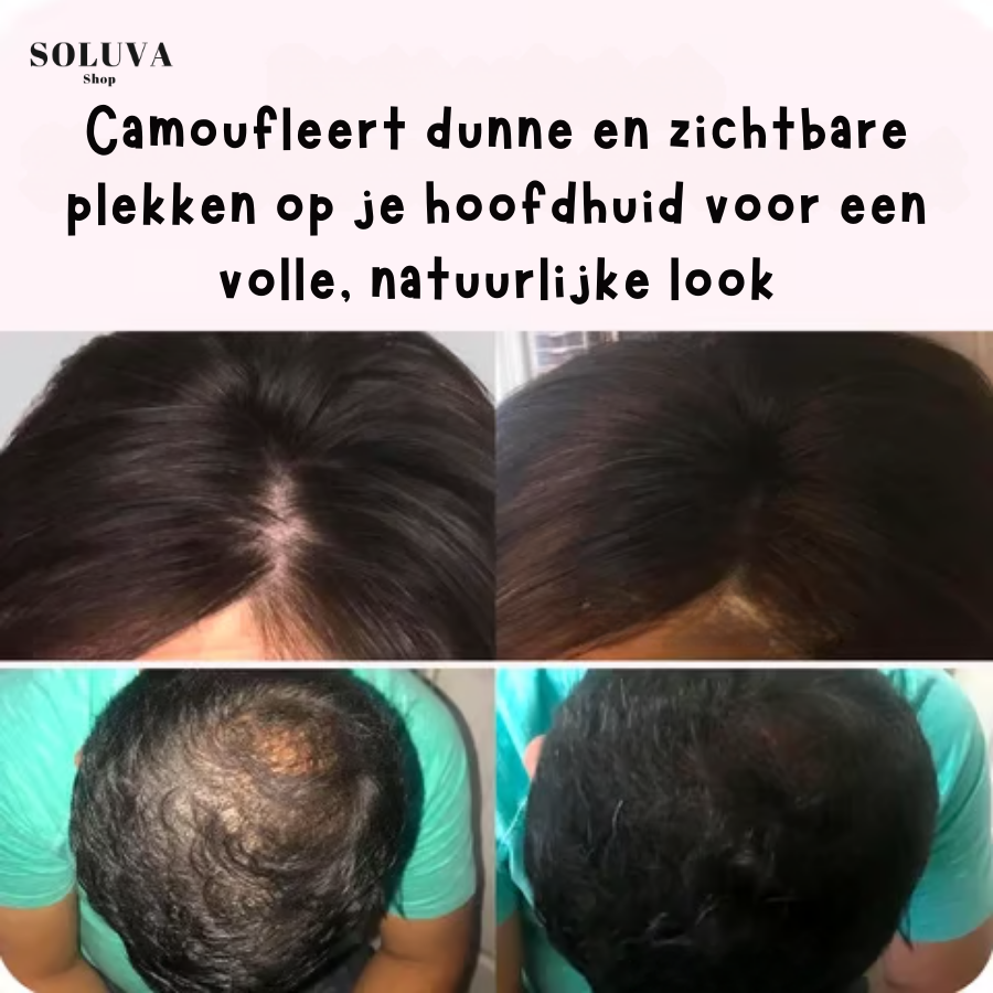 Anti-Haaruitgroei Poeder