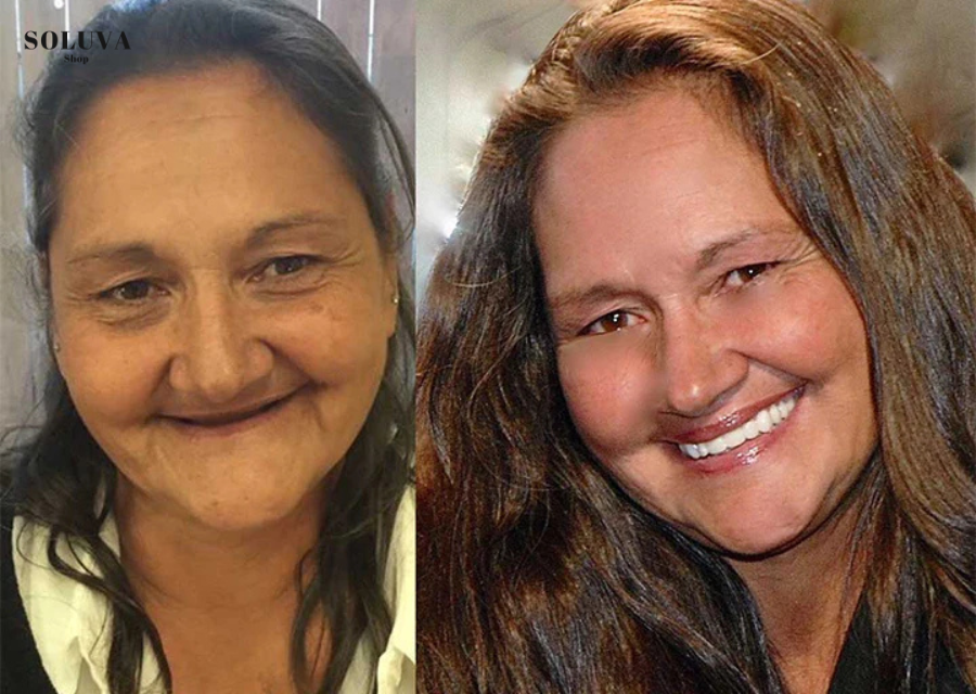 SmileSecure - Zekerheid bij elke lach - 2e Gratis!