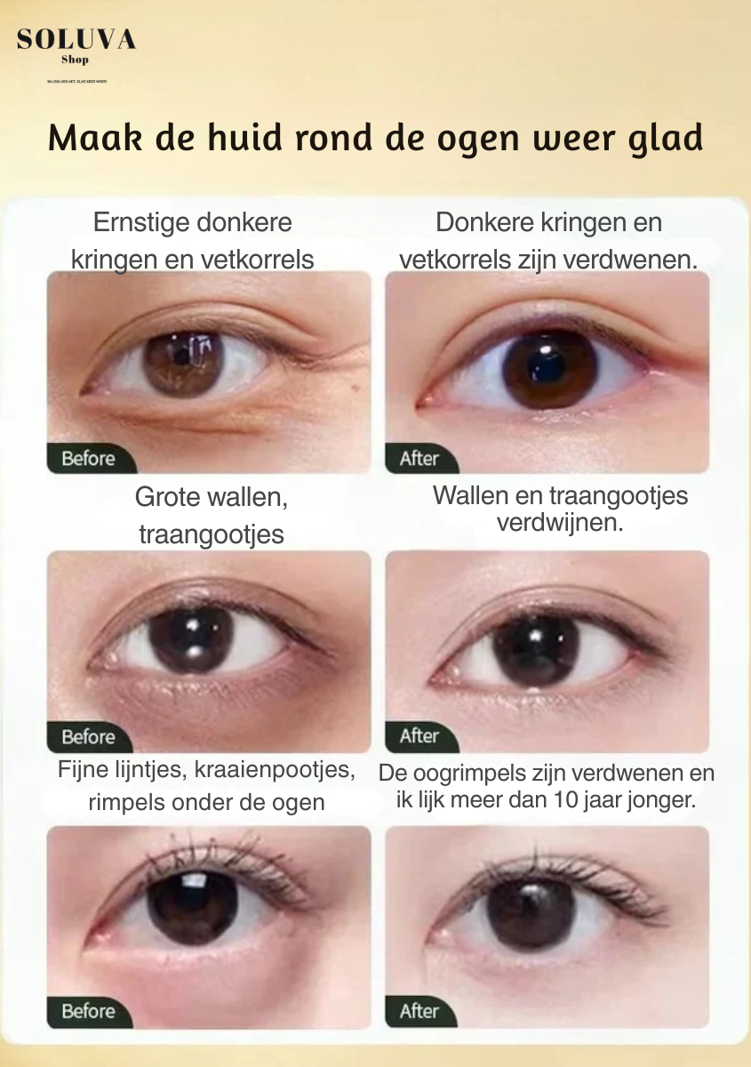 Hydraterende Anti Wallen Oogcrème