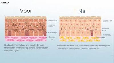 Huid Verhelderende Bodylotion 1+1 Gratis!