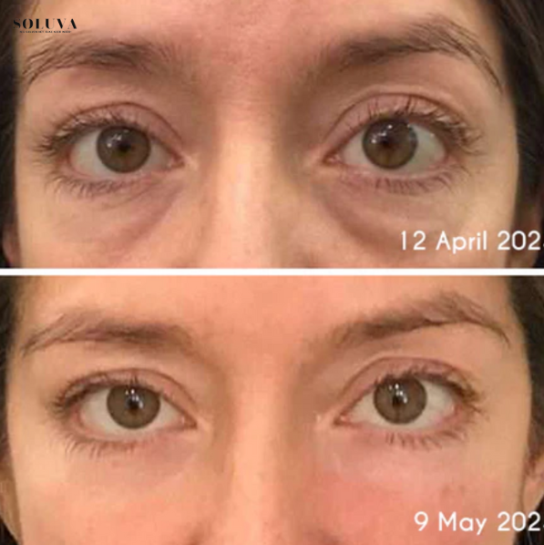 Pro Active Oog-Creme - 1+1 Gratis