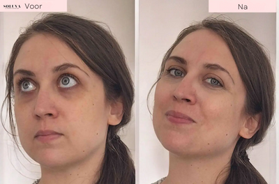 GlowLift - Oogverjongende Hersteltherapie