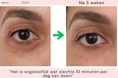 GlowLift - Oogverjongende Hersteltherapie