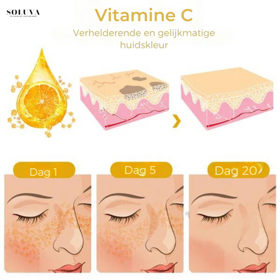 SkinShine - Huidverhelderende Gezichtsserum - 1+1 Gratis!