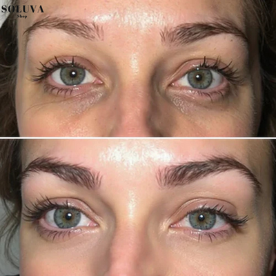 EyeLift Patches – Directe lifting en hydratatie voor vermoeide ogen - Wintersale