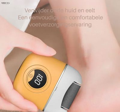 SmoothFoot - Oplaadbare Eeltverwijderaar