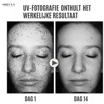 SkinShine - Huidverhelderende Gezichtsserum - 1+1 Gratis!