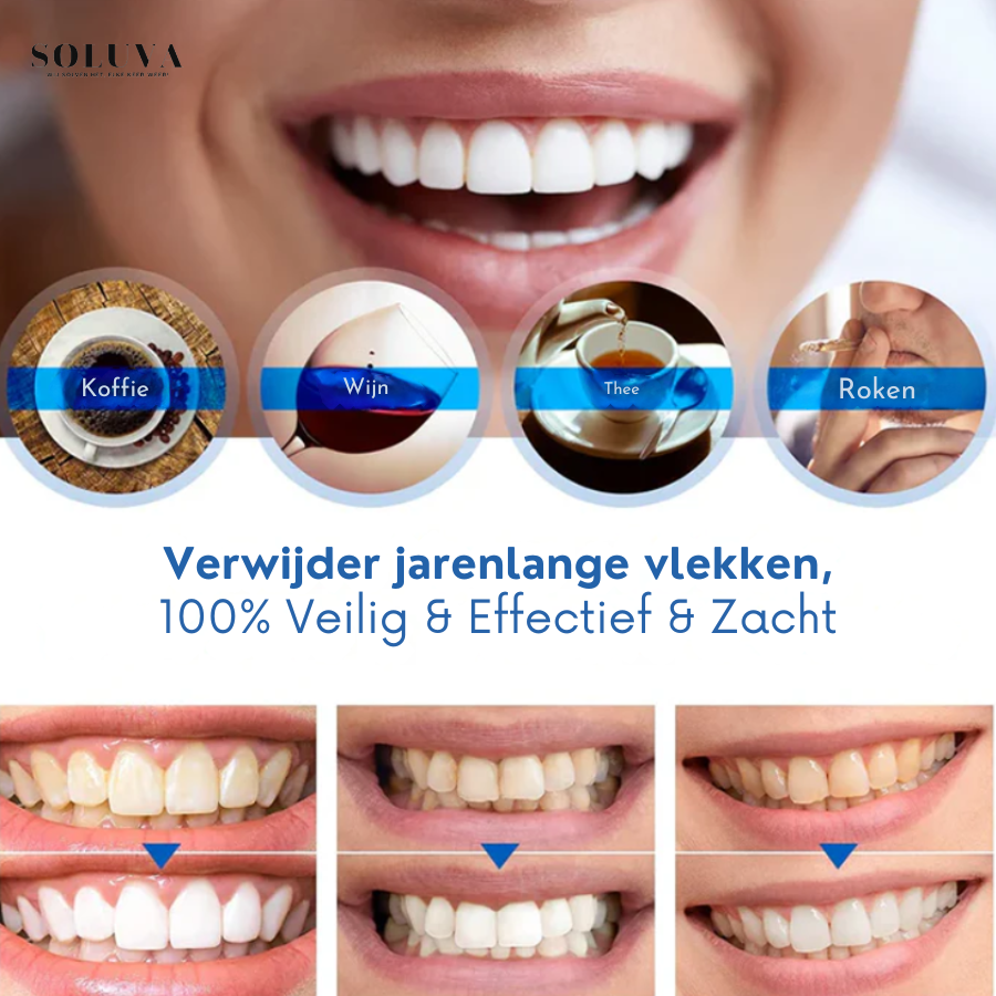 Teeth Essence - Ultra Sterke Tandenbleker - 1+2 Gratis!