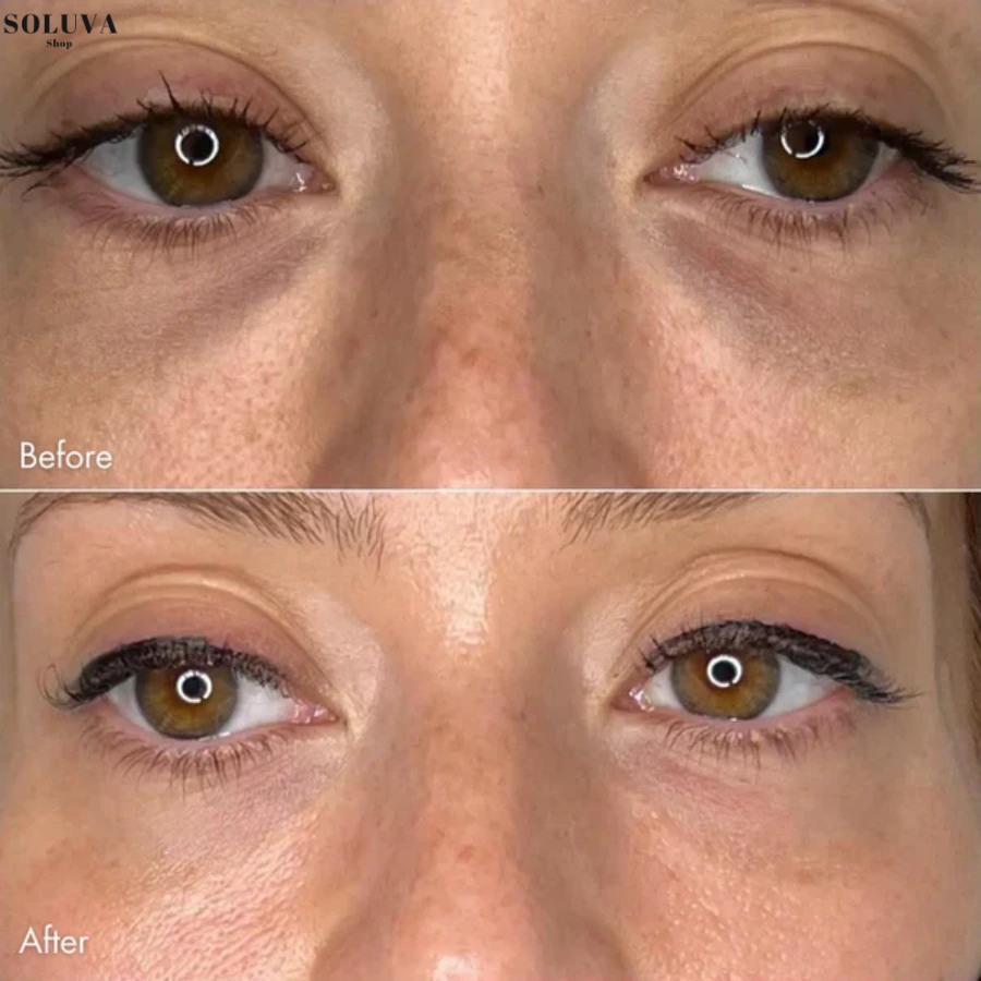 EyeLift Patches – Directe lifting en hydratatie voor vermoeide ogen - Wintersale