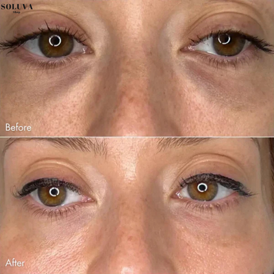 EyeLift Patches – Directe lifting en hydratatie voor vermoeide ogen - Wintersale