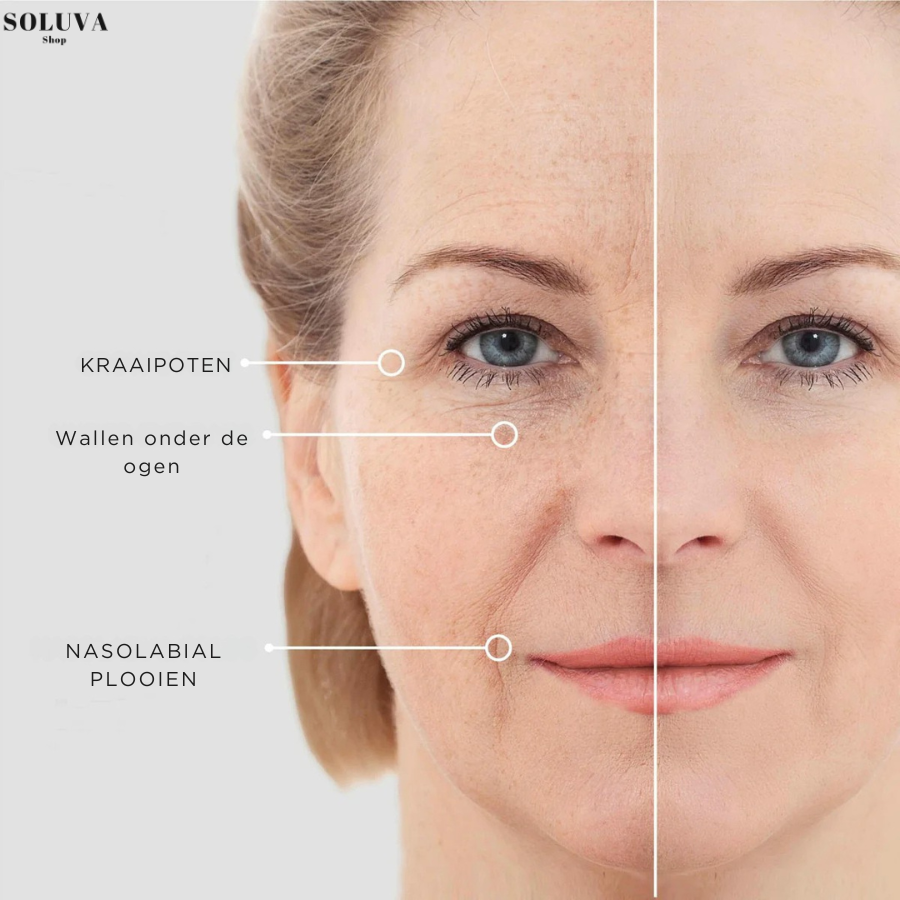 EyeLift Patches – Directe lifting en hydratatie voor vermoeide ogen - Wintersale