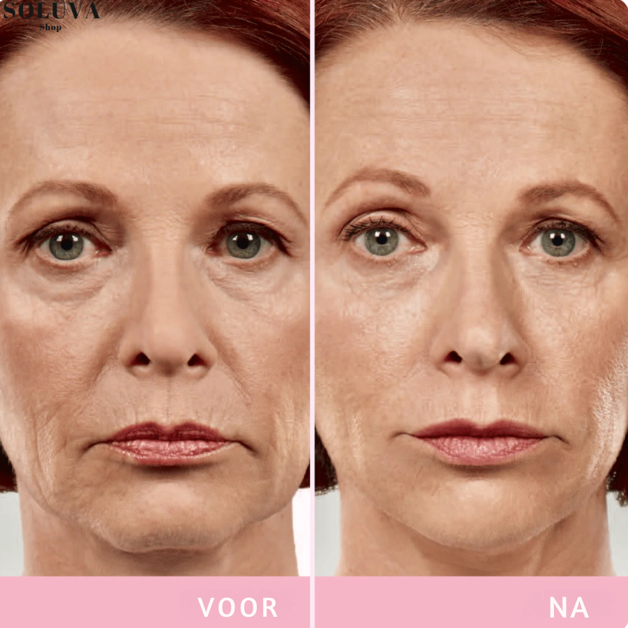 SlimFace  - Onzichtbare Facelift - Winteruitverkoop: 20 Stuks + 20 Stuks gratis!