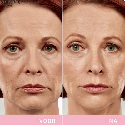 SlimFace  - Onzichtbare Facelift - Winteruitverkoop: 20 Stuks + 20 Stuks gratis!