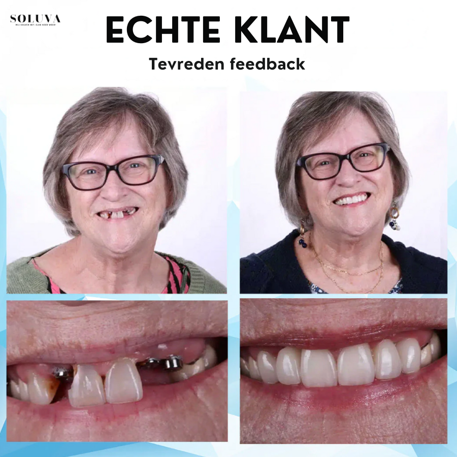 Siliconen Reline Gebitset - 1+1 Gratis!