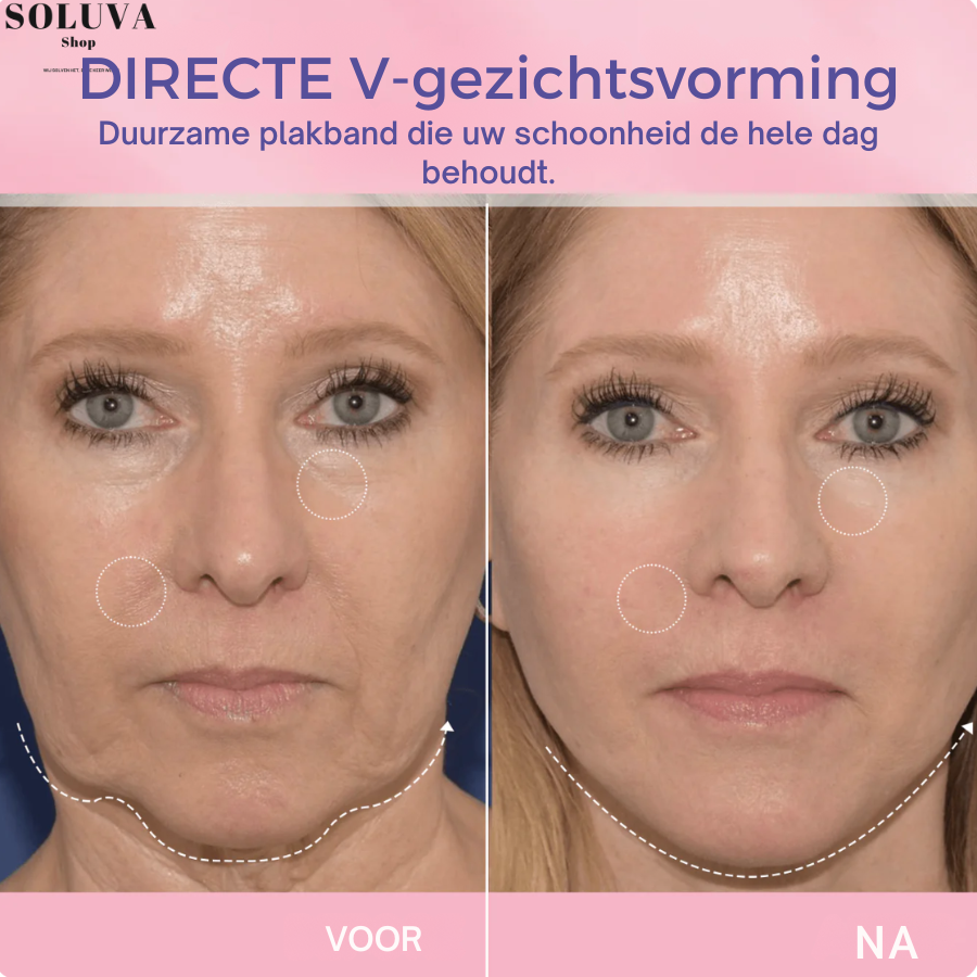 SlimFace  - Onzichtbare Facelift - Winteruitverkoop: 20 Stuks + 20 Stuks gratis!