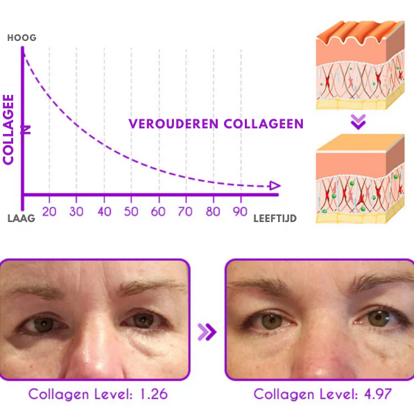 Pro Active Oog-Creme - 1+1 Gratis