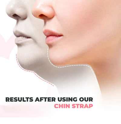 V-lijn - gezichtsverdunner | 1+1 gratis!