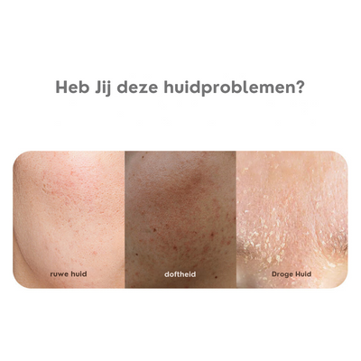 Hydraterende Anti-aging Moisturizer | 1+1 Gratis!